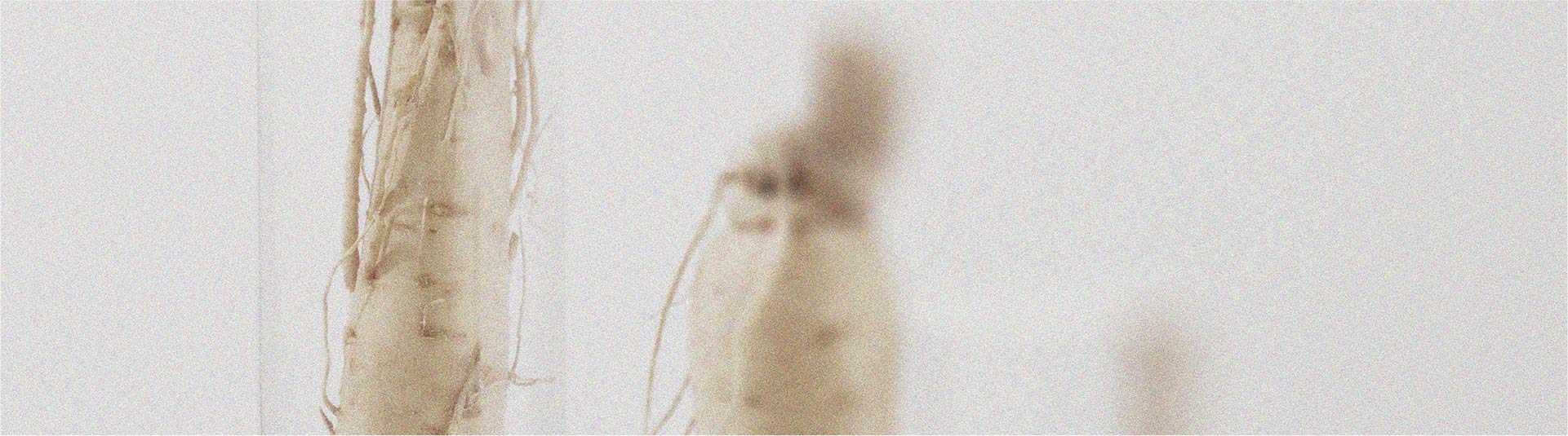 Everything you need to know about orthostatic hypotension