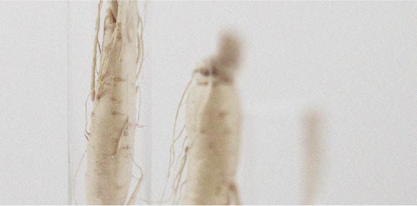 Everything you need to know about orthostatic hypotension