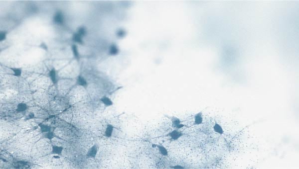 Could there be a link between cholesterol levels and cognitive decline?