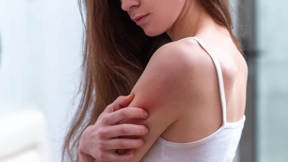 Mujer con eczema atópico que se rasca el brazo
