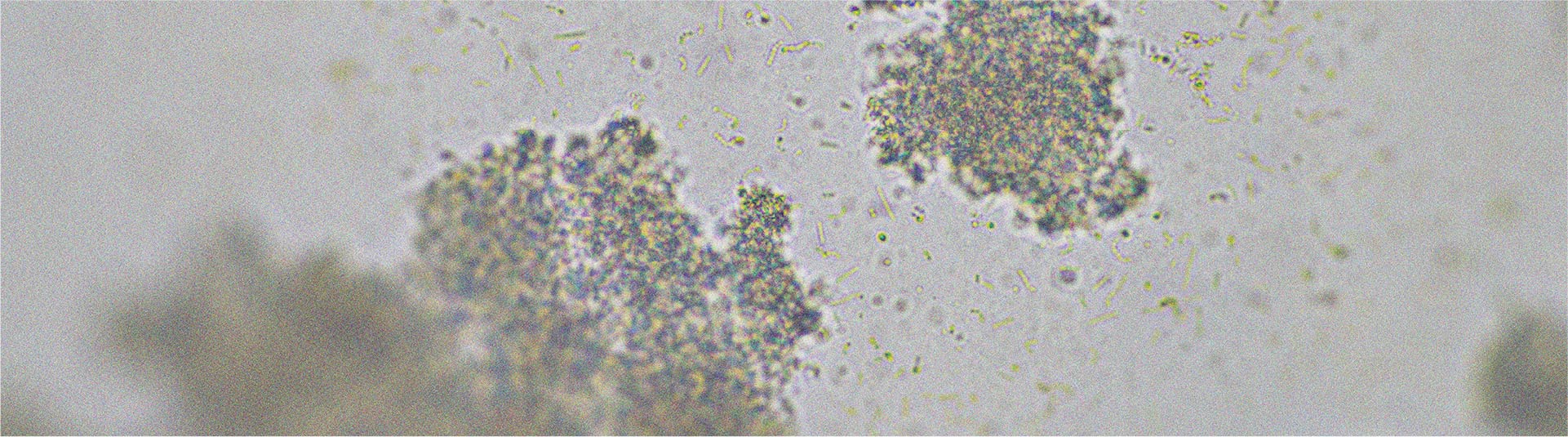 Probiotic strains that may help relieve diarrhea