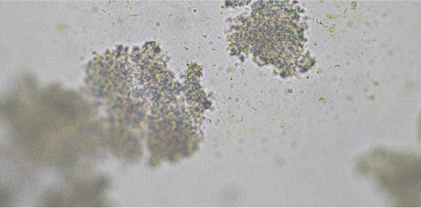 Probiotic strains that may help relieve diarrhea