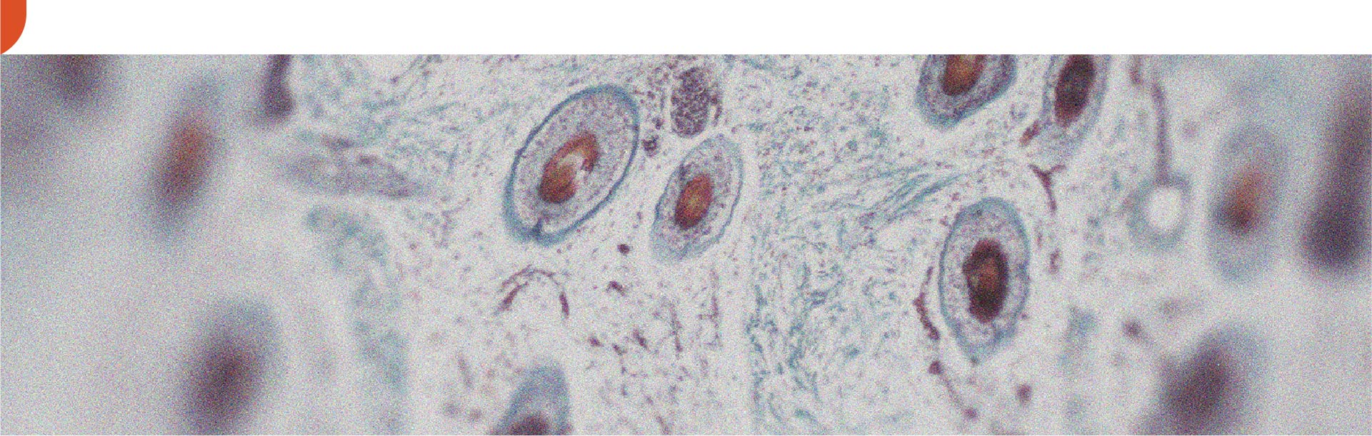 In what ways can vitamin A be good for the skin?